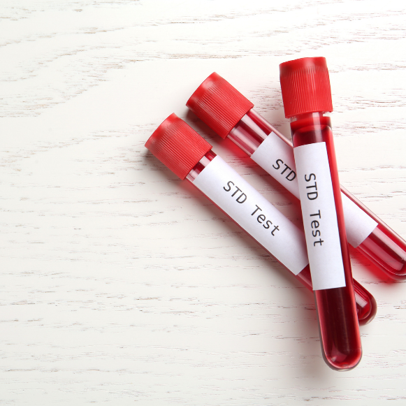 STD Testing Three blood sample tubes labeled "STD Test" on a white wooden surface